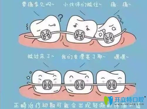 矯正牙齒過程痛不痛?說不疼都是假的,看臉型變化+緩解妙招