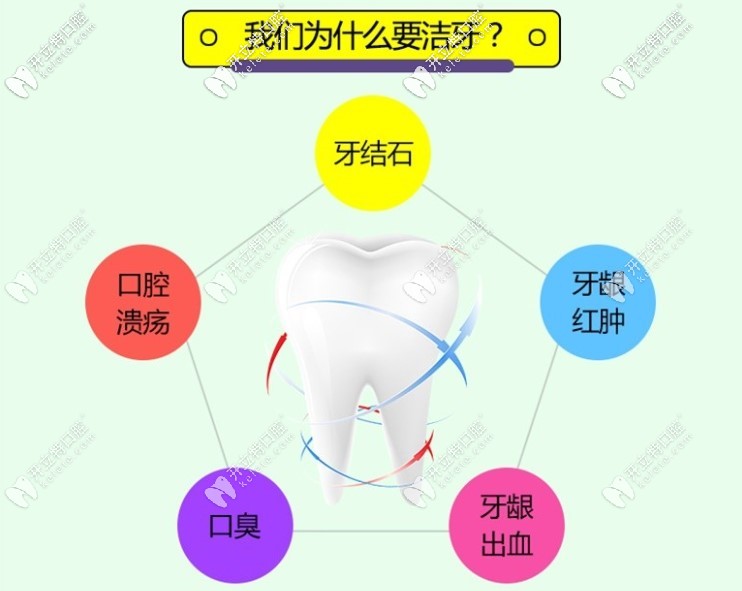 為什么要定期洗牙