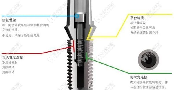 意大利bb種植體與瑞士iti比較，除價格外還有這些區(qū)別